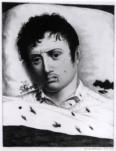 Observation de la fièvre jaune, c.1819 - Charles Lasteyrie du Saillant